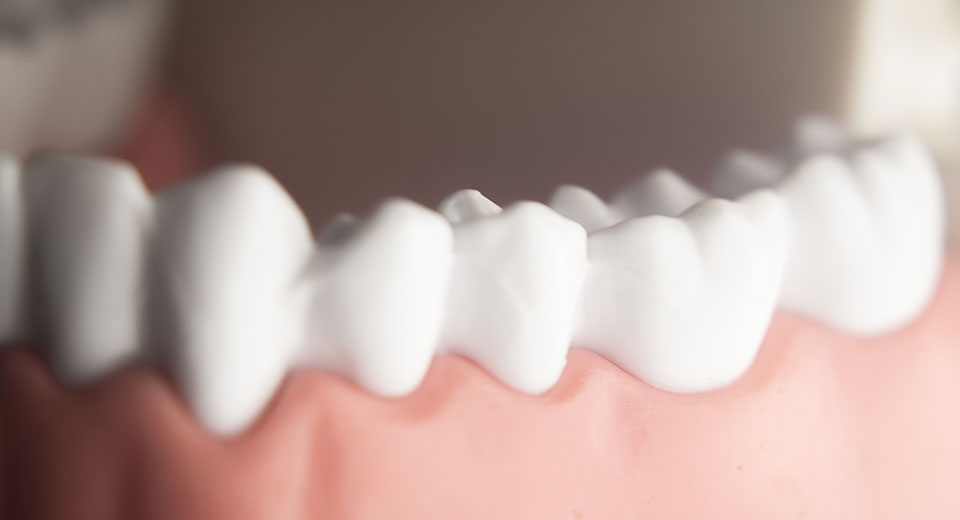歯周外科手術・歯周組織の再生療法